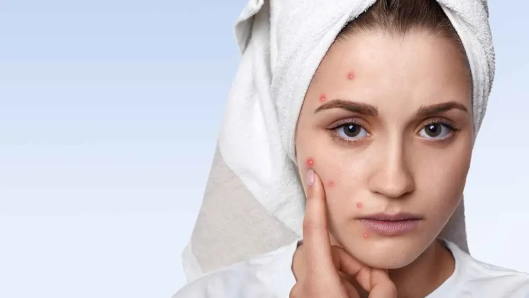 How to Naturally Take Care of Skin in Winter